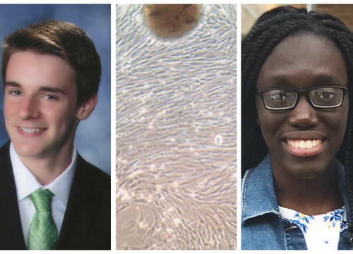 Ethan Trim '22 (left) and Nakesha Agyapong '22 (right) study lung stem cell aging in canines, such as this slide that depicts lung stem cells moving across a culture plate from a piece of lung tissue (center).
